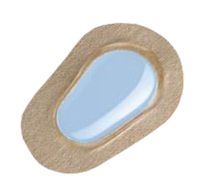 Ortolux Uhrglasverband Headerbild